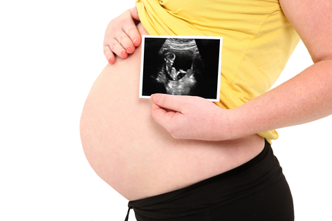 רעלת בהריון