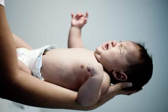 רשלנות מוהל בברית מילה