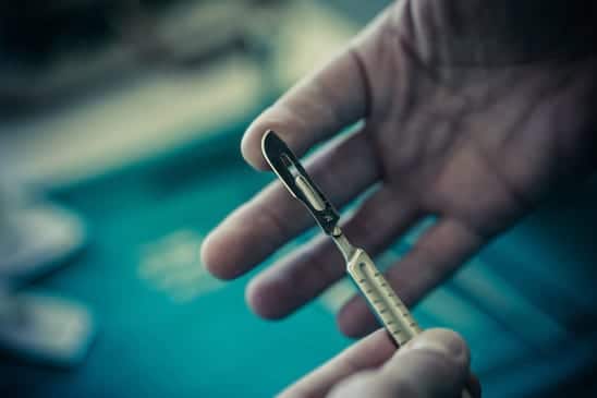 ניתוח לאחר מוות