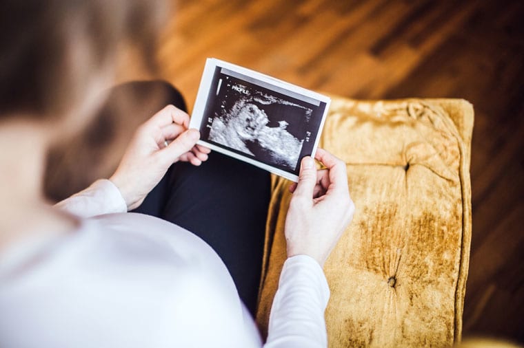 בדיקת אולטראסאונד לעובר