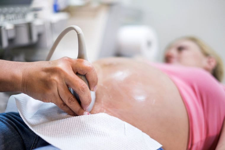 רשלנות הריון ולידה