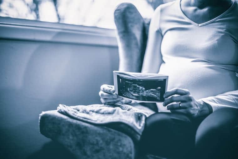 מושגי יסוד ברשלנות בהריון ולידה