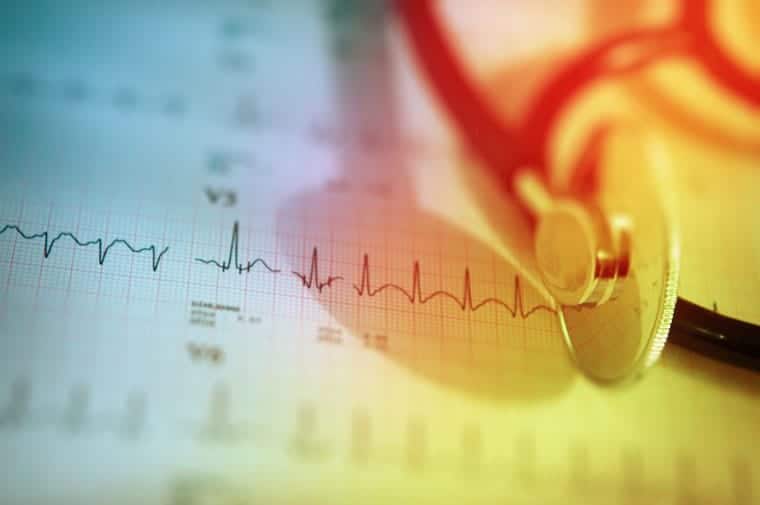 קיצור תוחלת חיים