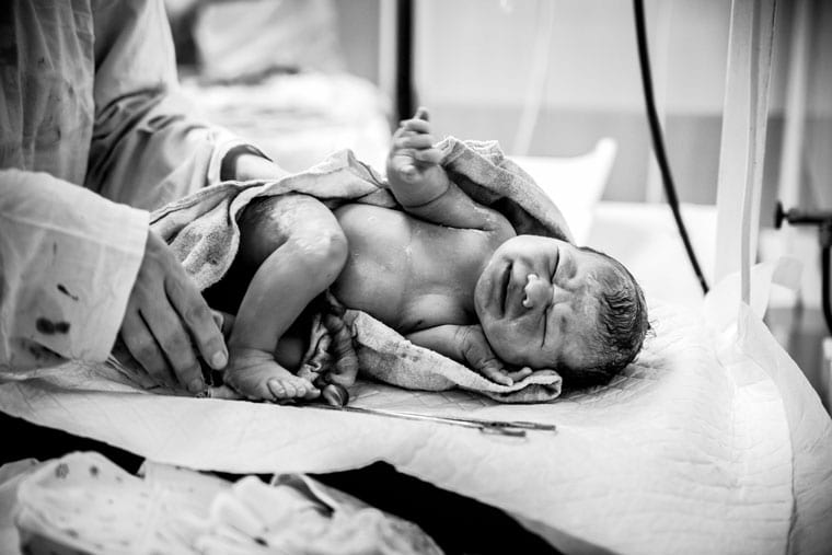 רשלנות רפואית שיתוק מוחין