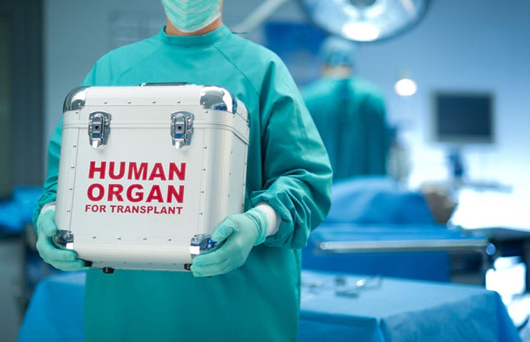 רשלנות בהשתלת איברים