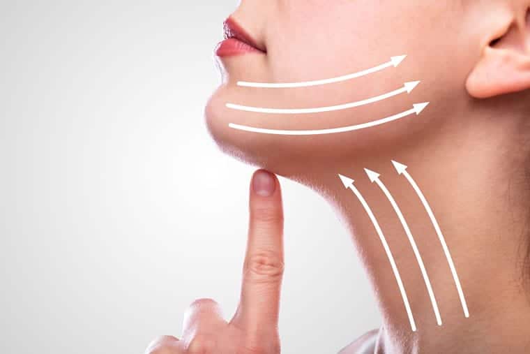 מתיחת צוואר