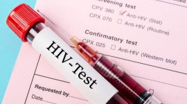 בדיקת HIV
